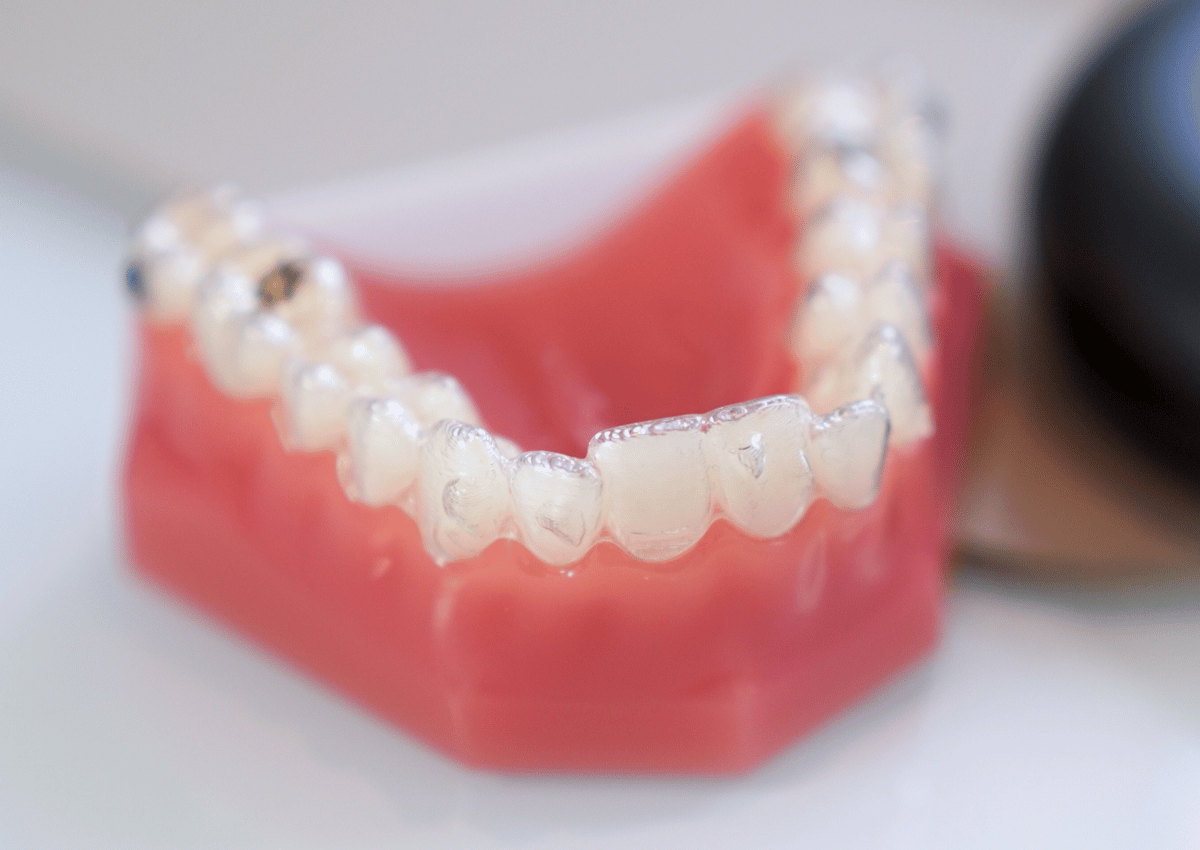 bournemouth southampton invisalign